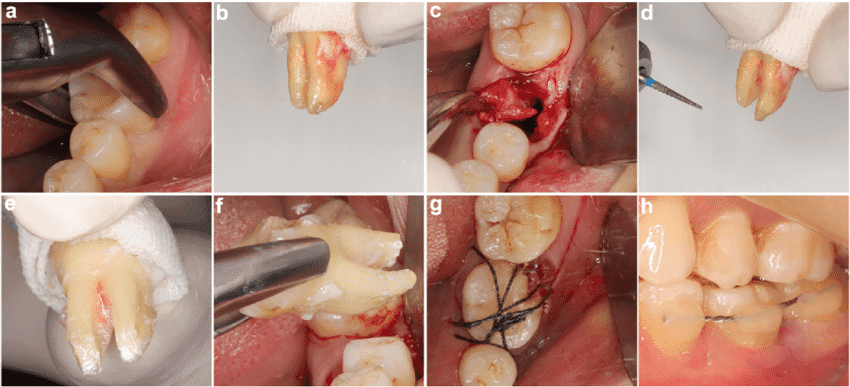 image-gambar-layanan-https://fdc-fast-storage-cdn.sgp1.cdn.digitaloceanspaces.com/public-medicaboo/1712277347140_cabut gigi.png