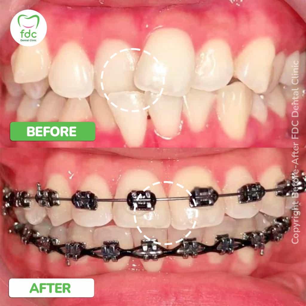 image-slider-image-0