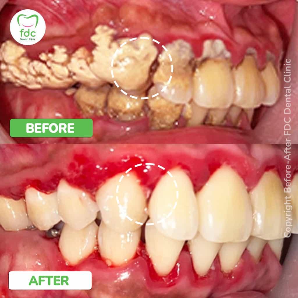 image-slider-image-0