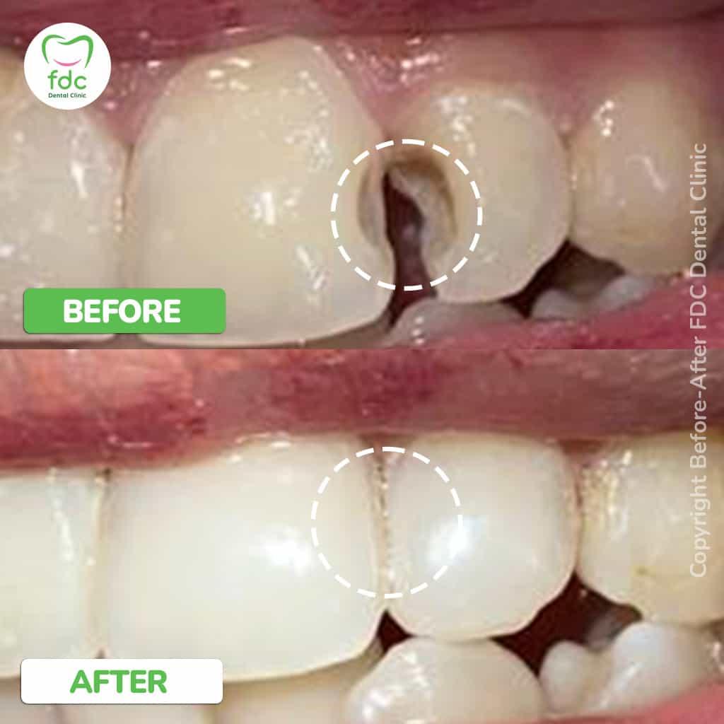 image-slider-image-1