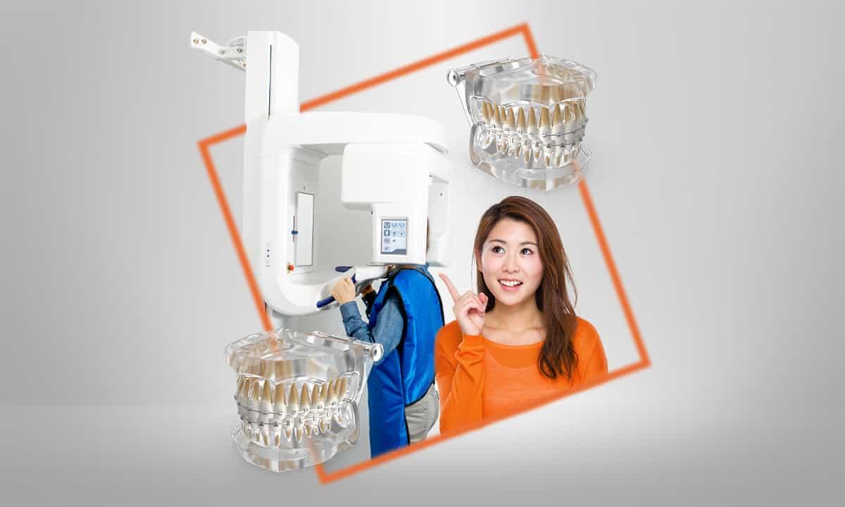 gambar-artikel-1649835163657_4 Perlukah Rontgen Gigi Sebelum Melakukan Pemasangan Behel_.jpg