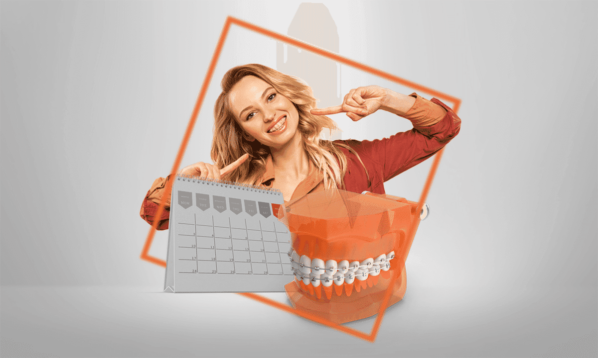 gambar-artikel-1649835461402_1 Mengapa Harus Rutin Mengganti Karet Behel_ 3 .png