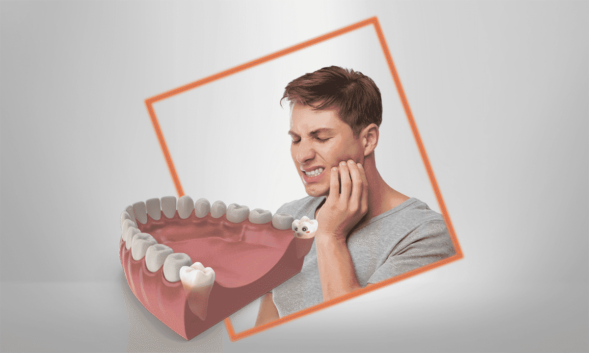 gambar-artikel-1649835519913_9 Cara Tepat Mengatasi Rasa Sakit Ketika Gigi Bungsu Tumbuh.png