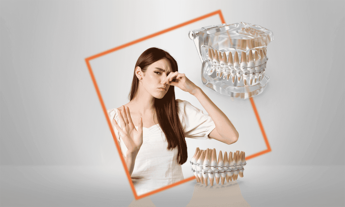 gambar-artikel-1649835550097_13 Tips Bebas Bau Mulut Saat Memakai Behel Gigi.png